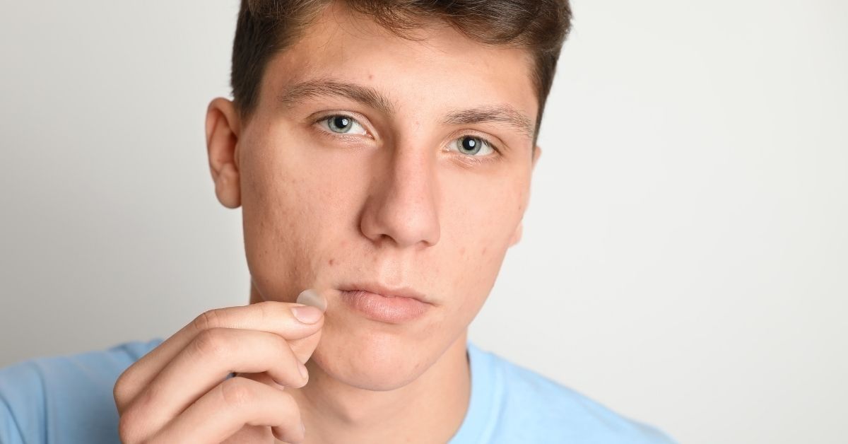 Acne adolescenza maschile