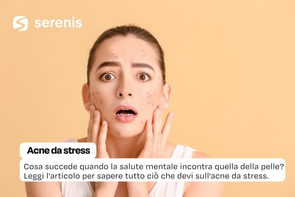 Acne da Stress