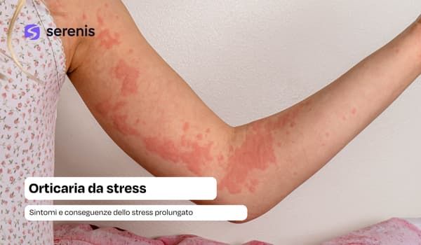 Sintomi di orticaria da stress