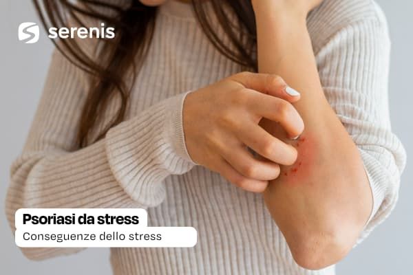 Psoriasi da stress definizione