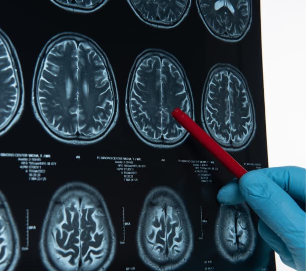 La fisiognomica e gli studi sul cervello di Lombroso