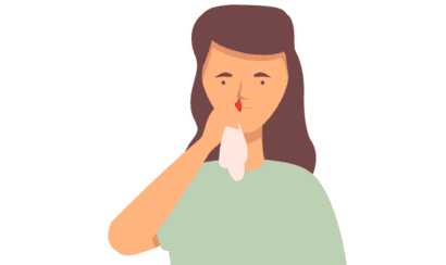 sangue dal naso per lo stress eccessivo