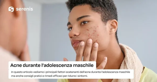 Acne durante l'adolescenza maschile