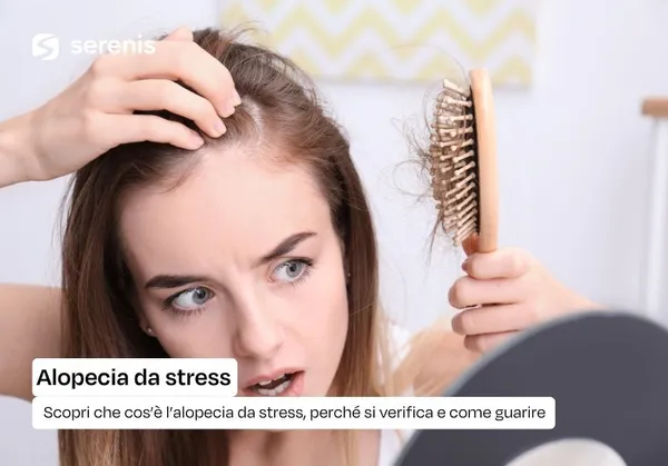 alopecia da stress