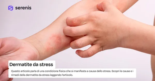 Dermatite da stress