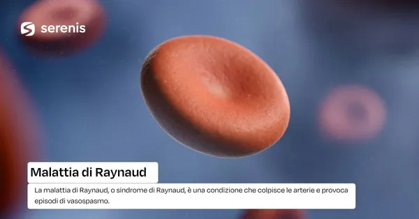 Malattia di raynaud