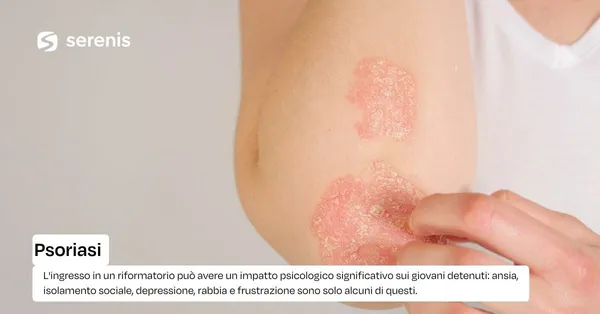 Psoriasi