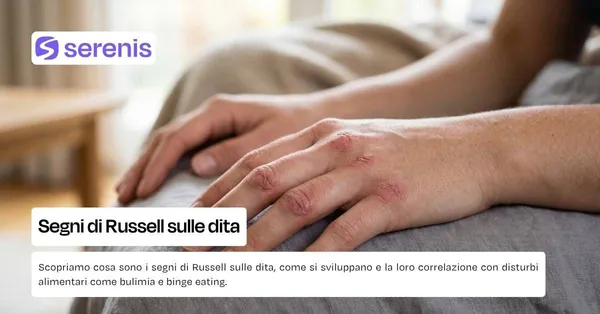Segni di russell