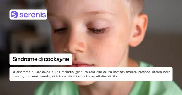 Sindrome di cockayne