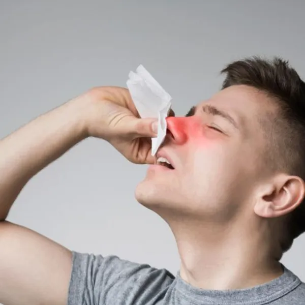 Lo stress può causare sanguinamenti dal naso?