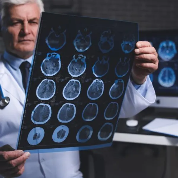 neurologo_38facc1391.jpg