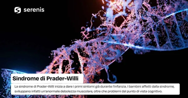 sindrome di prader willi