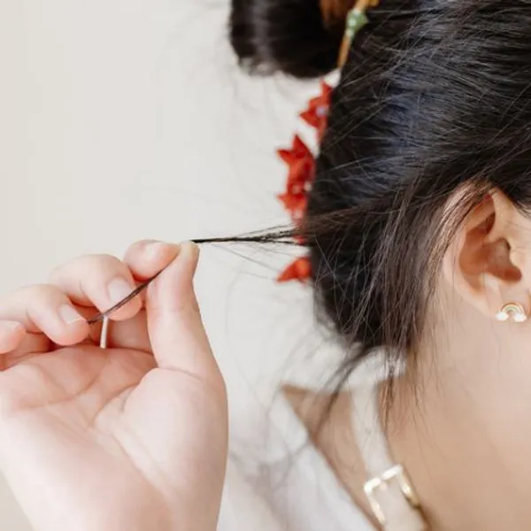 Tricotillomania