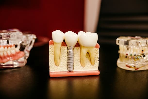 Odontofobia o stomatofobia: la paura del dentista